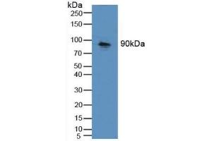 Detection of CDH16 in Mouse Kidney Tissue using Polyclonal Antibody to Cadherin 16 (CDH16) (Cadherin-16 anticorps  (AA 37-287))