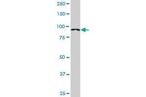 ACTN4 monoclonal antibody (M01), clone 4D10.