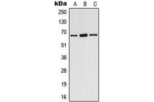 Western blot analysis of Estrogen Receptor alpha (pY537) expression in HeLa (A), SP2/0 (B), rat spleen (C) whole cell lysates. (Estrogen Receptor alpha anticorps  (C-Term, pTyr537))