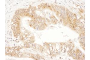 Immunohistochemistry (IHC) image for anti-Calcium/calmodulin-Dependent Protein Kinase Kinase 2, beta (CAMKK2) (AA 538-588) antibody (ABIN7455000)