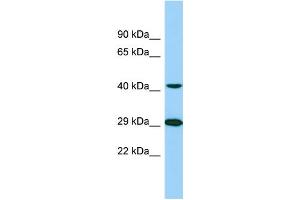 Western Blotting (WB) image for anti-Tubulin tyrosine Ligase-Like Family, Member 1 (TTLL1) (C-Term) antibody (ABIN2789136) (TTLL1 anticorps  (C-Term))