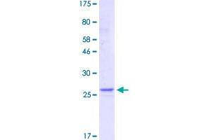 SDS-PAGE (SDS) image for Tumor Necrosis Factor (Ligand) Superfamily, Member 9 (TNFSF9) (AA 50-254) protein (His-DYKDDDDK-Strep II Tag) (ABIN4369886)