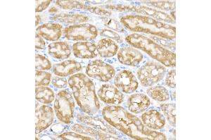 Immunohistochemistry of paraffin-embedded mouse kidney using MK4 Rabbit mAb (ABIN7268653) at dilution of 1:50 (40x lens). (MAP3K4 anticorps)