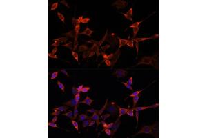 Immunofluorescence analysis of NIH-3T3 cells using S1/PR Polyclonal Antibody (ABIN6129890, ABIN6136741, ABIN6136742 and ABIN6221835) at dilution of 1:100 (40x lens).