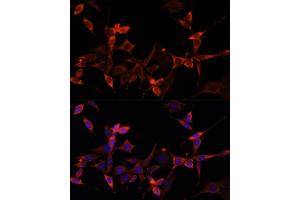 Immunofluorescence analysis of NIH-3T3 cells using S1/PR Polyclonal Antibody (ABIN6129890, ABIN6136741, ABIN6136742 and ABIN6221835) at dilution of 1:100 (40x lens).
