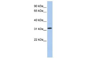 WB Suggested Anti-C15orf26 Antibody Titration: 0. (C15orf26/CFAP161 anticorps  (C-Term))