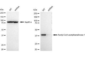 Western blotting analysis using Acetyl-CoA acetyltransferase 1 antibody (ABIN7797439).