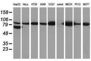 Image no. 5 for anti-Catenin (Cadherin-Associated Protein), beta 1, 88kDa (CTNNB1) antibody (ABIN1496893)