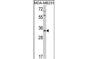 Western blot analysis of HPGD Antibody in MDA-MB231 cell line lysates (35ug/lane)