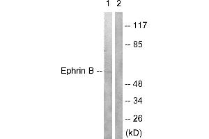 Western blot analysis of extracts from 293 cells treated with EGF (200ng/ml, 5mins), using Ephrin B (Ab-330) antibody (#B0010, Line 1 and 2). (EFNB1/2 (Tyr330) anticorps)