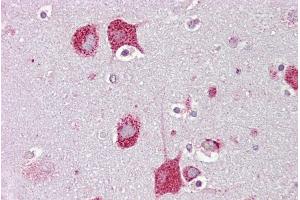 Immunohistochemistry with Brain, cortex tissue at an antibody concentration of 5µg/ml using anti-HEXA antibody (ARP61100_P050)