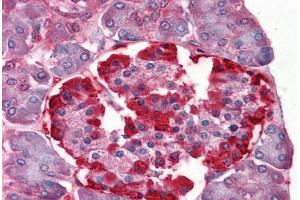 Human Pancreas: Formalin-Fixed, Paraffin-Embedded (FFPE)