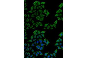 Immunofluorescence analysis of U2OS cells using TCN1 antibody.