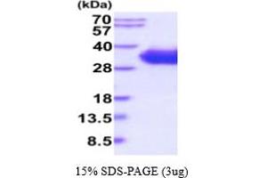 SDS-PAGE (SDS) image for CD2 (CD2) (AA 25-209) protein (His tag) (ABIN5854806)