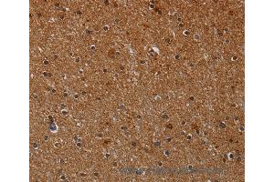 Immunohistochemistry of Human brain  using CYP1A2 Polyclonal Antibody at dilution of 1:40 (CYP1A2 anticorps)
