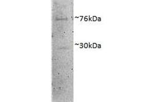 ABIN4902609 (1µg/ml) staining of Porcine MII Oocytes lysate (35µg protein in RIPA buffer). (DVL1 anticorps)