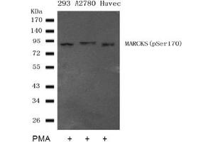 Image no. 2 for anti-Myristoylated Alanine-Rich Protein Kinase C Substrate (MARCKS) (pSer170) antibody (ABIN401558) (MARCKS anticorps  (pSer170))