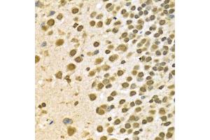 Immunohistochemistry of paraffin-embedded Mouse brain using HNRNPA2B1 antibody at dilution of 1:100 (x400 lens). (HNRNPA2B1 anticorps  (AA 1-180))