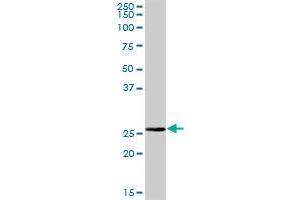 BPHL MaxPab polyclonal antibody.