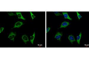 ICC/IF Image Pyruvate Kinase (liver/RBC) antibody detects Pyruvate Kinase (liver/RBC) protein at cytoplasm by immunofluorescent analysis.