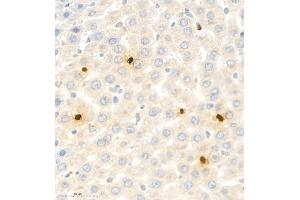 Immunohistochemistry analysis of paraffin embedded rat liver using S100A9 (ABIN7075497) at dilution of 1: 1800