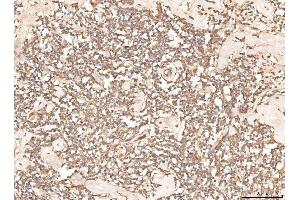 IHC analysis of BHMT using anti-BHMT antibody (ABIN7599940). (BHMT anticorps  (AA 13-386))