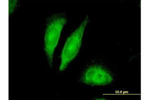Immunofluorescence of purified MaxPab antibody to BDNF on HeLa cell.