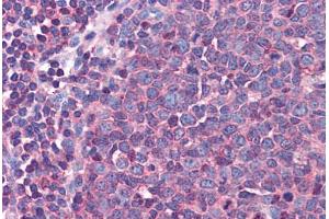 Human Tonsil: Formalin-Fixed, Paraffin-Embedded (FFPE)