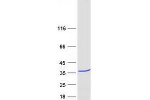 Validation with Western Blot