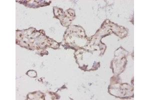 Immunohistochemistry of paraffin-embedded human placenta tissue using ABIN7145688 at dilution of 1:50 (BMP3 anticorps  (AA 362-472))
