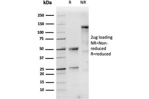 SDS-PAGE Analysis of Purified Cytokeratin 10 Rabbit Recombinant Monoclonal Antibody (KRT10/1948R). (Recombinant Keratin 10 anticorps)