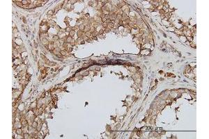 Image no. 1 for anti-phosphoinositide Kinase, FYVE Finger Containing (PIKFYVE) (AA 342-452) antibody (ABIN599337) (PIKFYVE anticorps  (AA 342-452))