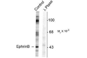 Image no. 1 for anti-Ephrin B1 (EFNB1) (pTyr317) antibody (ABIN372620) (Ephrin B1 anticorps  (pTyr317))