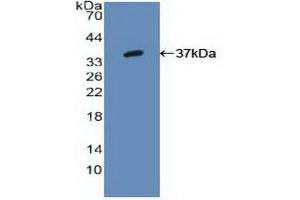 Western blot analysis of recombinant Human IRF1. (IRF1 anticorps  (AA 11-276))