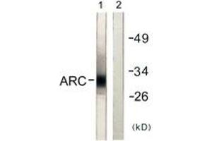 Western blot analysis of extracts from HeLa cells, using ARC Antibody. (ARC (AA 159-208) anticorps)