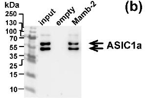 Western blot analysis of the ASIC1 subunits extraction from membrane fraction of mel P cells by affinity chromatography on NHS-sepharose resin coupled with mambalgin-2 (n = 3). (ASIC1 anticorps  (Extracellular Domain))