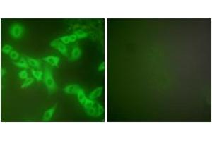 Immunofluorescence analysis of A549 cells, using Stefin B Antibody. (CSTB anticorps  (AA 49-98))