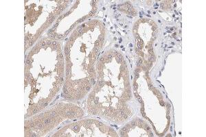 ABIN6267571 at 1/200 staining human kidney tissue sections by IHC-P. (SMAD3 anticorps  (pSer425))