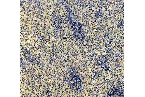 IHC analysis of CD79b using anti-CD79b antibody (ABIN3043398). (CD79b anticorps  (AA 29-229))