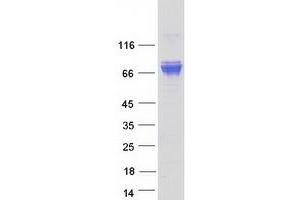Validation with Western Blot