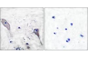 Immunohistochemistry analysis of paraffin-embedded human brain tissue, using Patched Antibody. (Patched 1 anticorps  (AA 1-50))