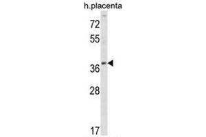 UBE2Q2 Antibody (Center) western blot analysis in human placenta tissue lysates (35 µg/lane). (UBE2Q2 anticorps  (Middle Region))
