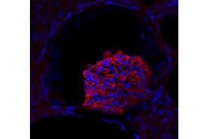 Immunostaining of a glomerolus in a mouse kidney section (dilution 1 : 200).