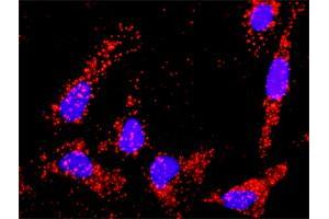 Proximity Ligation Analysis of protein-protein interactions between TGFB2 and APP.