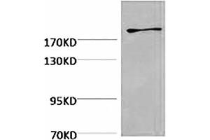 Western blot analysis of Hela, diluted at 1:2000. (Fibronectin anticorps)