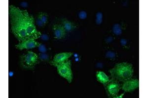 Anti-TBC1D4 mouse monoclonal antibody (ABIN2454446) immunofluorescent staining of COS7 cells transiently transfected by pCMV6-ENTRY TBC1D4 (RC212105). (TBC1D4 anticorps)