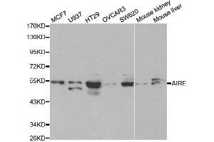 Western blot analysis of extracts of various cell lines, using AIRE antibody. (AIRE anticorps  (AA 30-130))