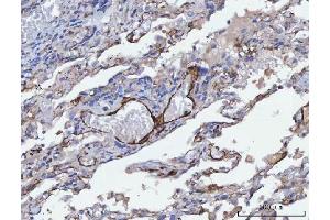 IHC analysis of Tropomyosin 2/TPM2 using anti-Tropomyosin 2/TPM2 antibody (ABIN7603245).