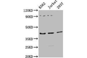Western Blot Positive WB detected in: K562 whole cell lysate, Jurkat whole cell lysate, 293T whole cell lysate All lanes: ADIPOR1 antibody at 1:2500 Secondary Goat polyclonal to rabbit IgG at 1/50000 dilution Predicted band size: 43 kDa Observed band size: 43 kDa (Adiponectin Receptor 1 anticorps  (AA 1-63))