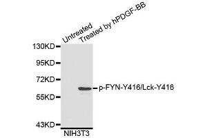 Western blot analysis of extracts of NIH3T3 cells, using Phospho-FYN-Y416/Lck-Y416 antibody (ABIN5995595).